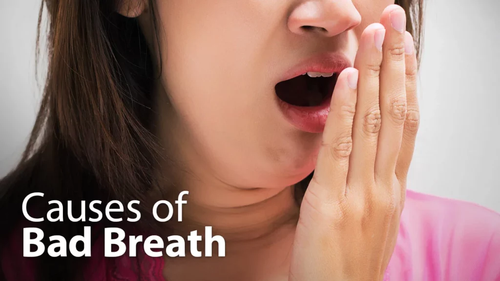 Causes of bad breath