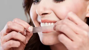 teeth whitening