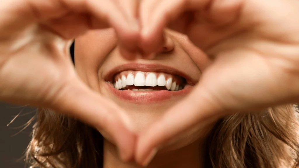 Smile Makeover