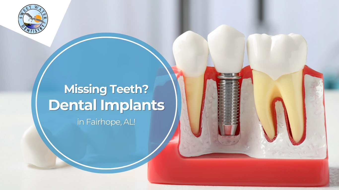 Do You Have To Go Without Teeth When You Get Implants? Missing Teeth? Dental Implants in Fairhope, AL
