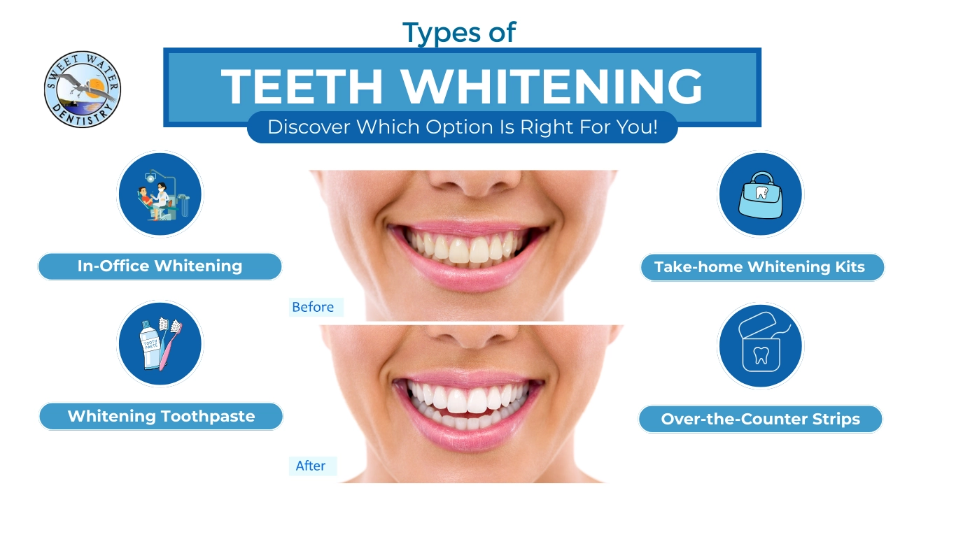 Sweet-Types of teeth