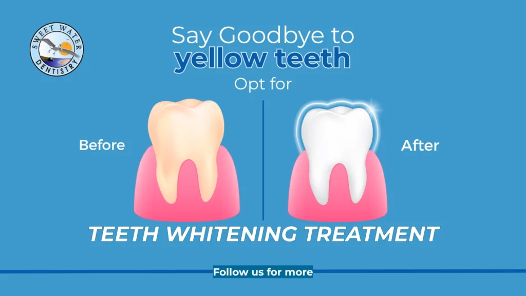 teeth whitening