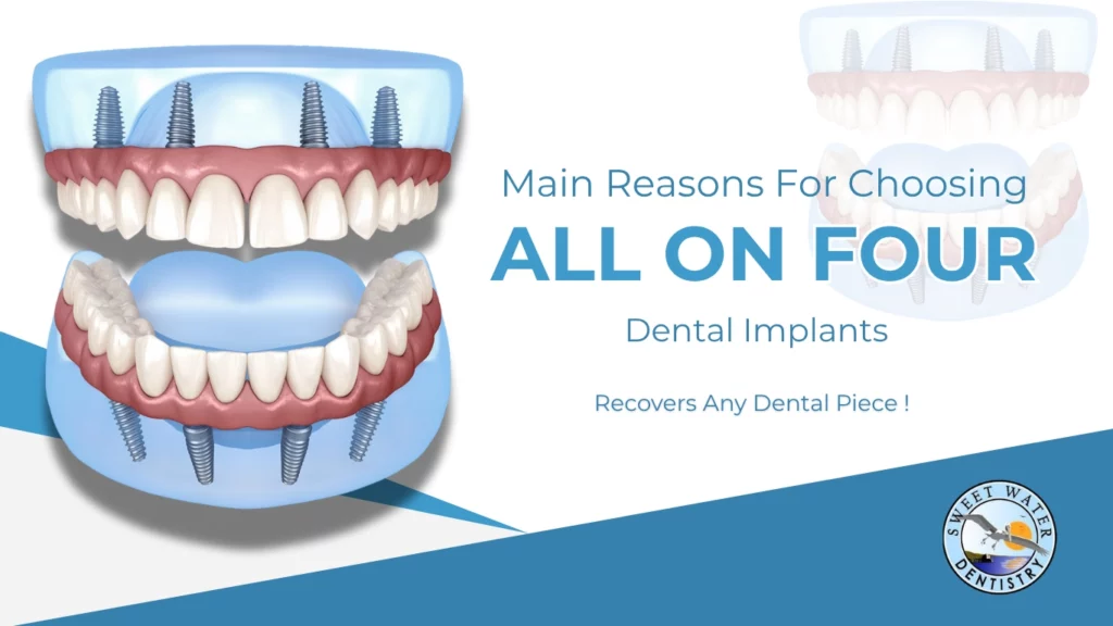 Sweetwater-All On Four Dental Implants