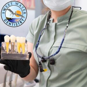 dental implants