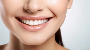 Veneer