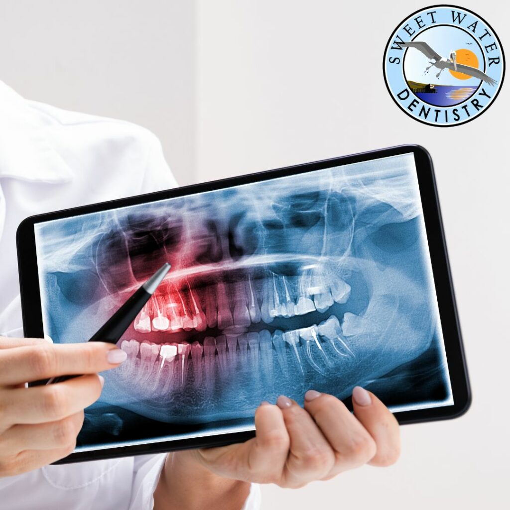 Signs of an Infected Tooth