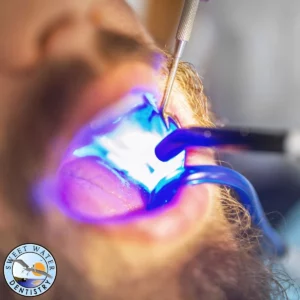 fillings