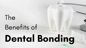 composite bonding