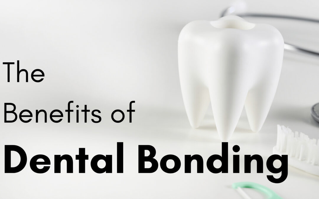 Benefits Of Dental Bonding