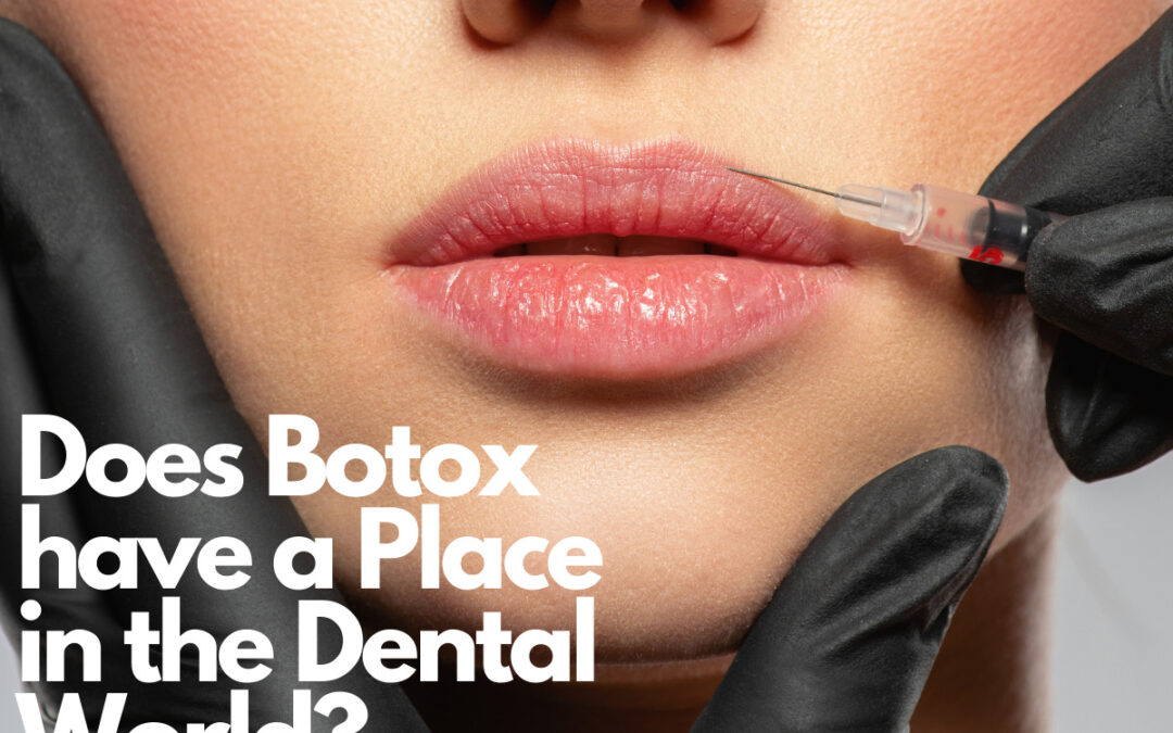 Botox For Bruxism