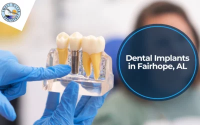 Dental Implants in Fairhope, AL