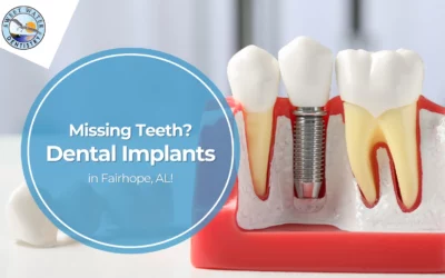 Missing Teeth? Dental Implants in Fairhope, AL