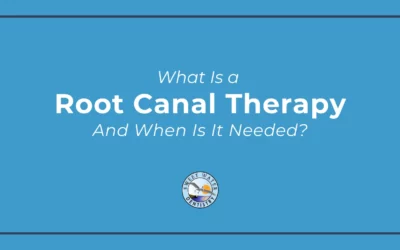 What Is Root Canal Therapy and When Is It Needed? in Fairhope, AL