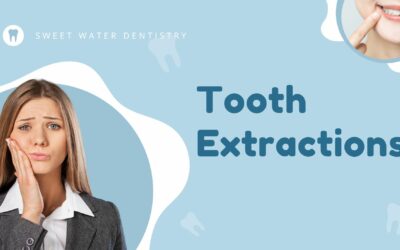 Fairhope, AL Tooth Extractions