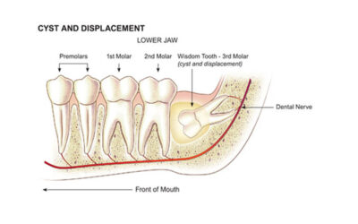 Dental Offices Located in Robertsdale AL