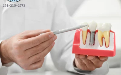 Dental Implants for Missing Teeth in Fairhope, AL