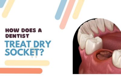 Fairhope Dentistry Dry Socket Information