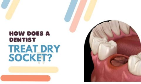 Fairhope Dentistry Dry Socket Information | Sweet Water Dentistry