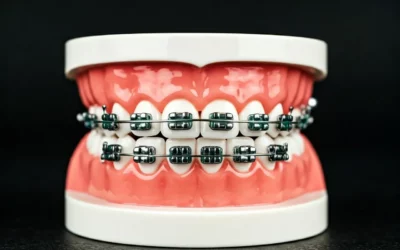 10 Things You Should Know About Adult Orthodontics