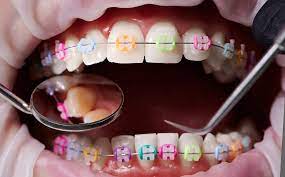 Fairhope Orthodontists