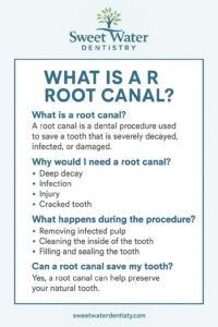 root canal