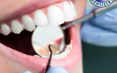 How Long Do Fillings, Crowns, And Other Dental Restorations Last?