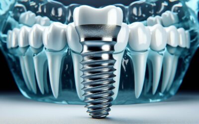 What Is The Highest Quality Dental Implant?