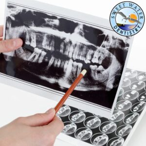 Missing Tooth